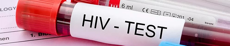 Анализы на ВИЧ на Братиславской